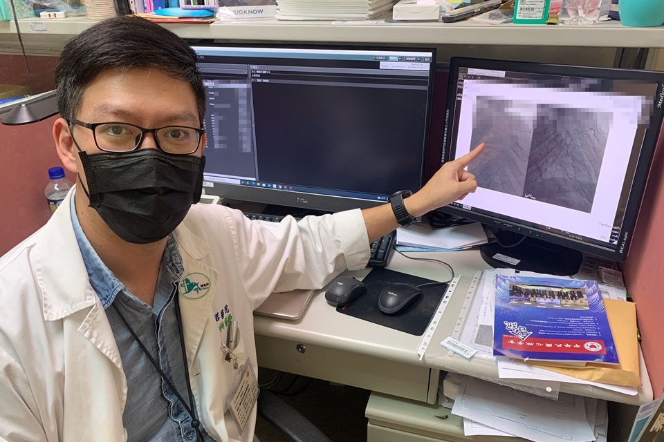 心臟內科醫師陳翰興說明鑽石旋磨術