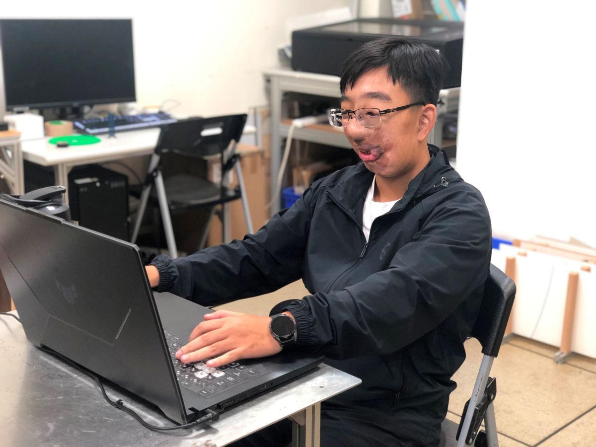 曾因外觀遭受霸凌的晏緒恩鼓勵顏損學子「不要讓別人的話定義自己。」